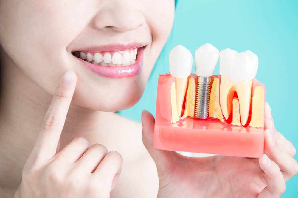 Best Dentist in Surat Vesu 	Dental Clinic in Surat Vesu	Dental Implants in Surat Vesu