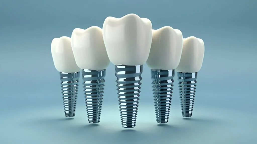 Best Dentist in Surat Vesu 	Dental Clinic in Surat Vesu	Dental Implants in Surat Vesu