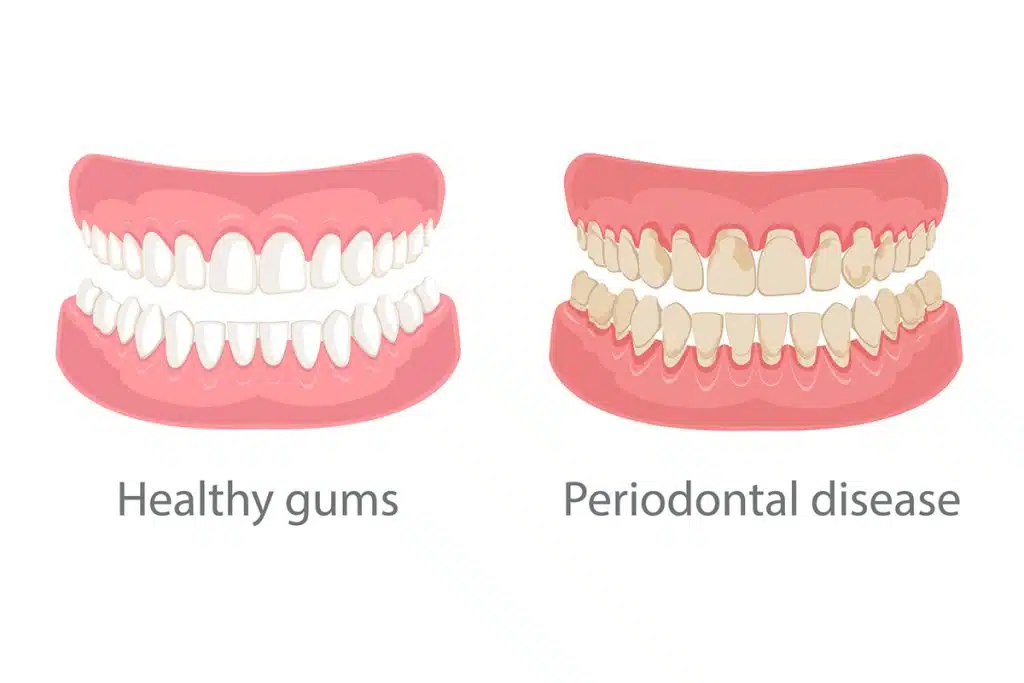 Best Dentist in Surat Vesu 	Dental Clinic in Surat Vesu	Dental Implants in Surat Vesu