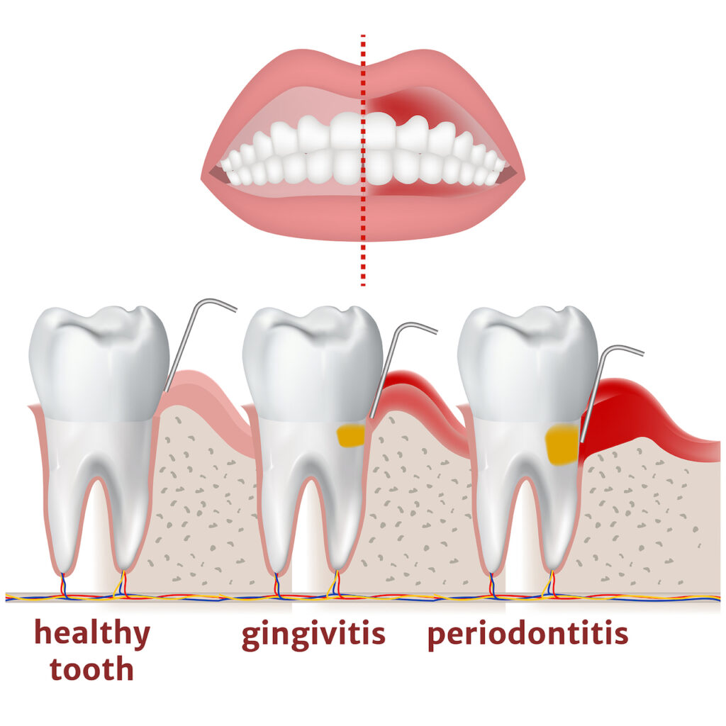 Best Dentist in Surat Vesu 	Dental Clinic in Surat Vesu	Dental Implants in Surat Vesu