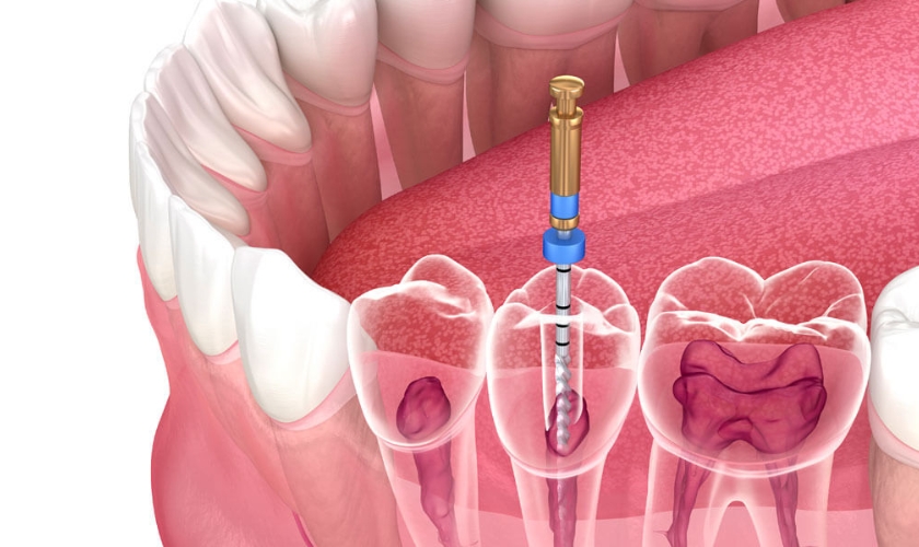 Best Dentist in Surat Vesu 	 
Dental Clinic in Surat Vesu	 
Dental Implants in Surat Vesu